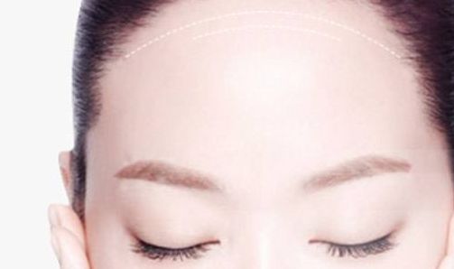 南京做修復(fù)雙眼皮哪家好？解析南京修復(fù)雙眼皮的最佳選擇