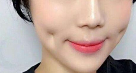 上海超聲刀哪家醫(yī)院做得好？專家推薦，超聲刀手術最佳選擇