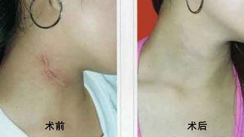 上海中西醫(yī)結(jié)合醫(yī)院整形美容科靠譜嗎？聽說口碑不錯！