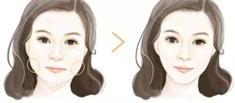 上海哪家下頜骨醫(yī)院好？解析上海下頜骨疾病常見病例及專業(yè)治療！