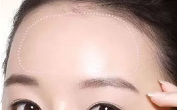蘇州哪家黃褐斑醫(yī)院好？專業(yè)醫(yī)生推薦，讓你告別黃褐斑困擾！