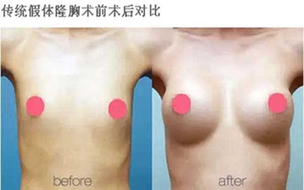 溫州雍禾醫(yī)院信譽(yù)如何？求推薦占家佳醫(yī)生植發(fā)效果如何？或溫州雍禾醫(yī)院口碑怎么樣？哪位醫(yī)生適合占家佳植發(fā)