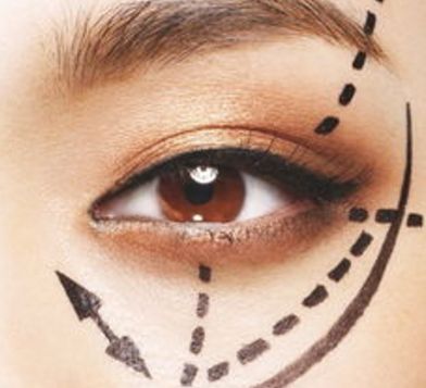 蘭州眼睛美容醫(yī)院哪家好？揭秘蘭州市最受歡迎的眼睛美容醫(yī)院排行榜！