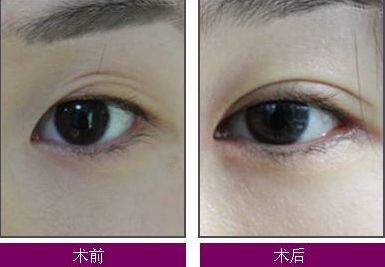 煙臺(tái)整疤痕哪家醫(yī)院好？了解煙臺(tái)整疤痕醫(yī)院的綜合評(píng)價(jià)和治療效果