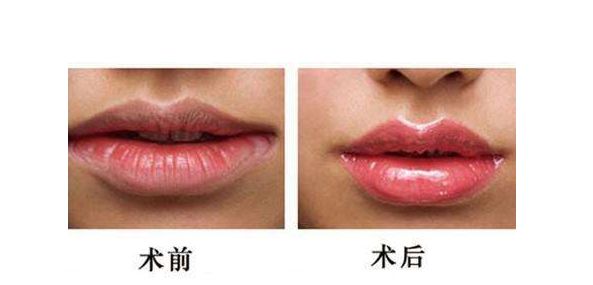 江蘇哪家醫(yī)院做激光祛斑好？
