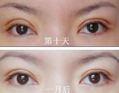長春哪家醫(yī)院治痘痘好？了解長春市治療青春痘的?？漆t(yī)院及價格