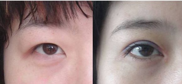 北京豐胸整形醫(yī)院哪家好？綜合評價和患者口碑推薦
