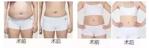 信陽(yáng)去整形哪家醫(yī)院好？名副其實(shí)信陽(yáng)市最佳整形醫(yī)院TOP推薦