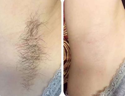 上海整形醫(yī)院哪家的好？最權(quán)威的排名榜單來幫你挑選！