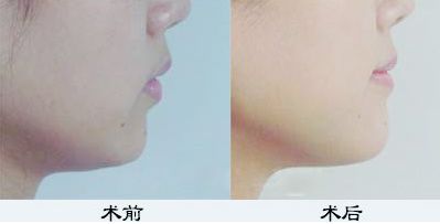 鄭州鼻綜合哪家醫(yī)院好？TOP醫(yī)療機(jī)構(gòu)大揭秘