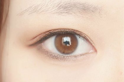 深圳北大醫(yī)院自體脂肪填充的效果如何？何君君醫(yī)生的資料和擅長(zhǎng)特點(diǎn)分享！