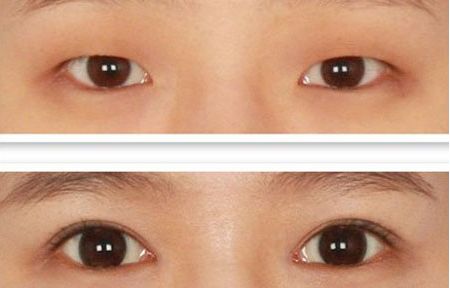 北京整容科好的醫(yī)院有哪些？中關(guān)村整形醫(yī)院綜合實(shí)力領(lǐng)先！
