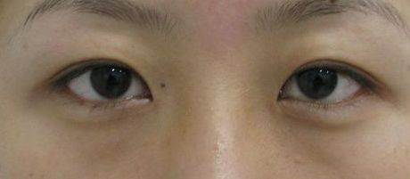 南寧哪家美容整形醫(yī)院口碑好又實(shí)惠？