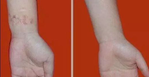 杭州哪家醫(yī)院看喉嚨好？排名最好的專業(yè)醫(yī)院推薦