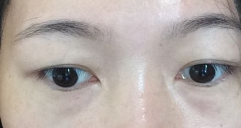 杭州祛雀斑哪家醫(yī)院好？選擇最適合您需求的專業(yè)祛雀斑醫(yī)院