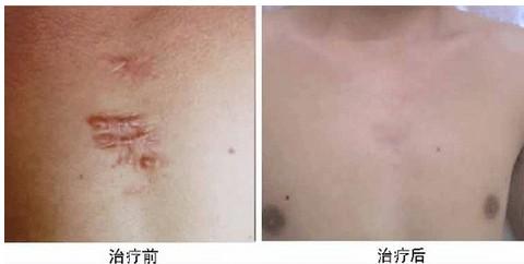 2023洛陽去除眼尾紋皺紋正規(guī)醫(yī)生排行前十(單寶奇、王靜、劉淑蘭為您塑造好身材)