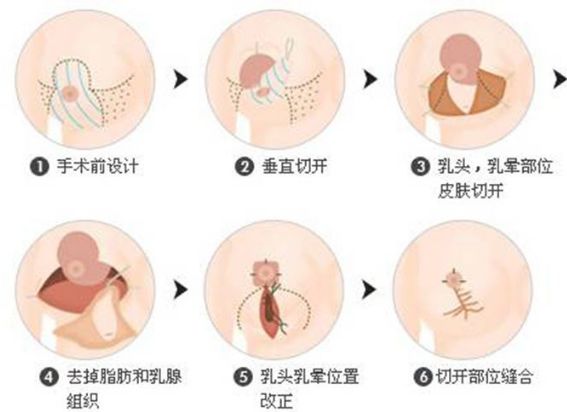保定的整形醫(yī)院哪家好？全面解析保定整形醫(yī)院排名、口碑、專業(yè)團(tuán)隊(duì)等