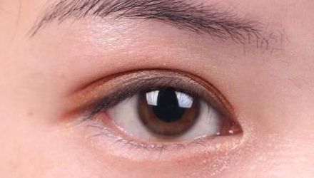 蘇州雙眼皮修復(fù)醫(yī)院排名及口碑，哪家醫(yī)院修復(fù)效果最好？