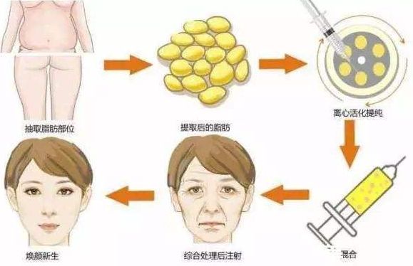 重慶整形磨骨哪家醫(yī)院好？整形醫(yī)院排行榜解讀，選擇最適合您的醫(yī)院！