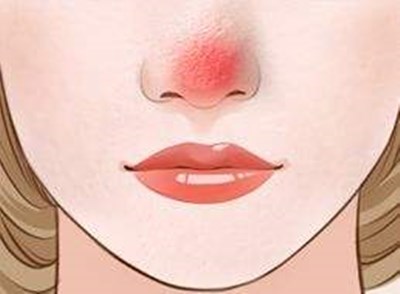 廣州最新開設(shè)的軍事美容整形醫(yī)院，王世虎是權(quán)威整形專家，手術(shù)價(jià)便宜