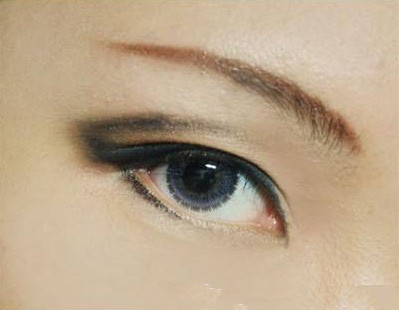 深圳五位雙眼皮修復(fù)專家，專業(yè)排行揭曉！