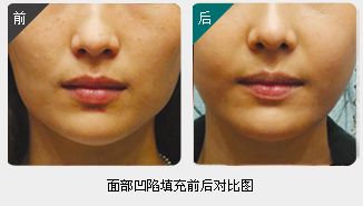 錦州整形美容醫(yī)院哪家靠譜？醫(yī)療技術(shù)如何？