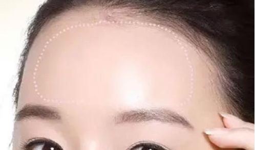 常州治療脫發(fā)哪家醫(yī)院靠譜？