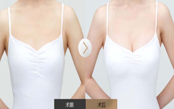 浙江同德醫(yī)院整形醫(yī)生名單、整形案例圖，為大家呈現(xiàn)