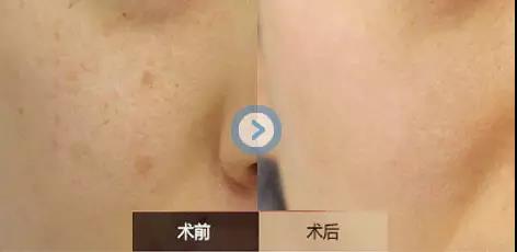 2023葫蘆島干細(xì)胞祛疤印排行TOP10的專(zhuān)家(高建華、朱杰、周栩口碑評(píng)價(jià)好)