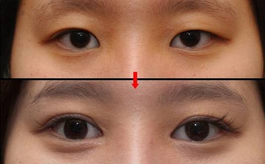 2023佛山大腿吸脂瘦腿專家評(píng)分前10強(qiáng)(謝漢平、曹碧浪、佛山曙光金子劉云忠龍頭地位穩(wěn)固)