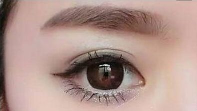 長(zhǎng)沙哪位醫(yī)生擅長(zhǎng)解燦割雙眼皮技術(shù)？