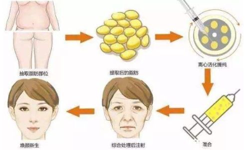 鄭州鼻整形哪家醫(yī)院好？一篇權(quán)威評測解答你的疑惑！