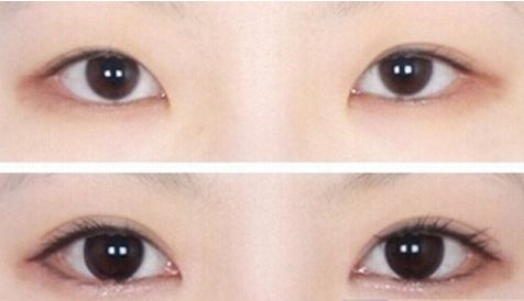 濟南哪家醫(yī)院的豐胸手術效果最好？