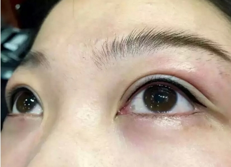 王濱福醫(yī)生的鼻部整形技術：精湛匠心，震撼美圖！會令您瞠目結舌嗎？