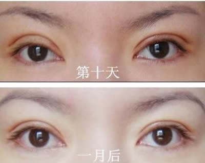 2023上海分型祛痘美膚醫(yī)生口碑榜前十位(鄒文強、孫文海、王君實力前三跑不脫！)