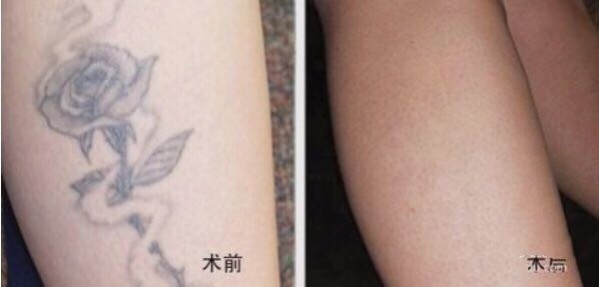 不二選擇！上海鼻修復(fù)專家徐永豐、劉仁輝搶占熱門名單成功！個(gè)人實(shí)力攀升不可阻擋！