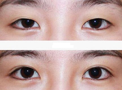 廣州整容鼻子技術(shù)排名前列的醫(yī)院有哪些？