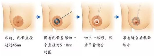 在哈爾濱做除皺哪家醫(yī)院好？選擇專業(yè)除皺醫(yī)生，享受高質(zhì)量護(hù)理服務(wù)