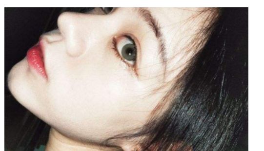 找一家靠譜的汕頭去除疤痕醫(yī)院？看這里！