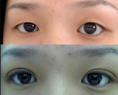 唐山哪家鼻子整形醫(yī)院好？權(quán)威專家為您解答