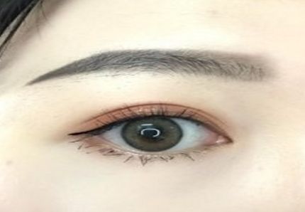 鄭州激光理哪家醫(yī)院好？解析鄭州市新興激光理療醫(yī)院評(píng)價(jià)與潛力