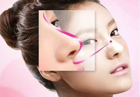 深圳駝峰鼻矯正哪家好？專業(yè)醫(yī)生推薦與真實案例分享！