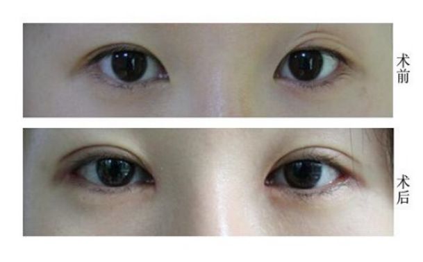桂林有哪些去痘療效好的醫(yī)院值得推薦？
