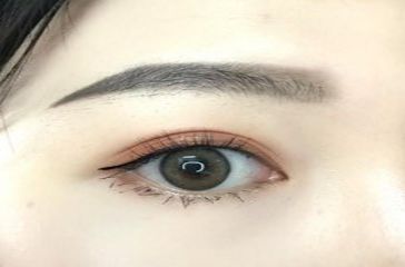 上海去黑眼圈哪個(gè)醫(yī)院好？專家推薦的實(shí)力醫(yī)院排行榜