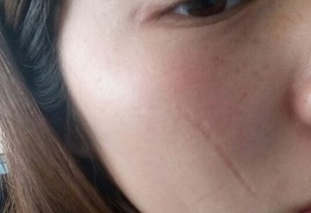 濟南哪家醫(yī)院做豐胸效果好？排名靠前，技術專業(yè)的有哪些？