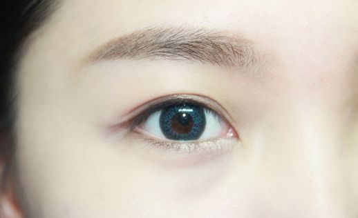 無錫頸脖紋線雕整形醫(yī)院推薦指南：提升魅力，告別頸紋困擾