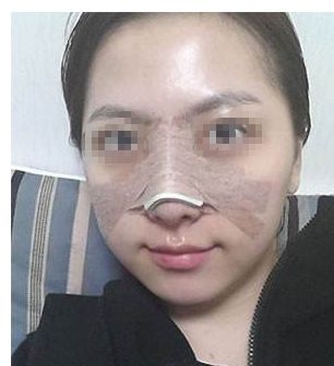 告別私處暗沉！盡顯白皙嬌嫩，激光漂紅來一次就有效果嗎？巧妙俘獲男人的心！