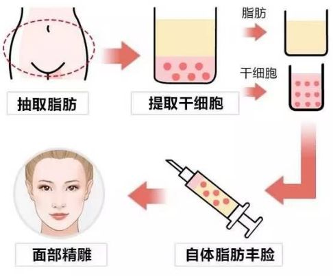有效美白祛斑方法匯總，專業(yè)醫(yī)美與低成本自制全覆蓋！