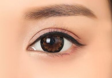 隆鼻修復(fù)手術(shù)多久可以進行整形恢復(fù)措施？