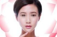 面部吸脂后如何避免松弛與反彈？深度解析！